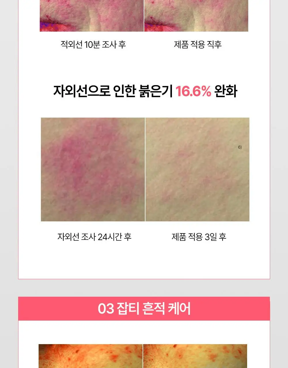 [7월올영픽/붉은기진압] 피지오겔 레드수딩 로자테카 레드니스 리듀싱 세럼 30ml 기획(+15ml) 상세페이지 12